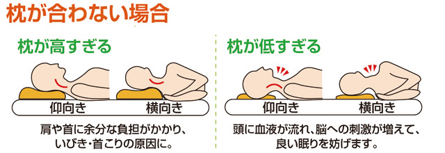 枕が合っていない場合の症状