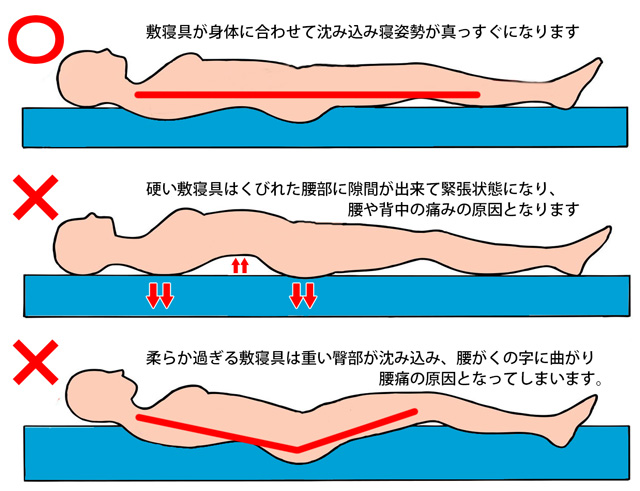 朝の腰痛は敷寝具が原因 自分に合ったマットレスを選びましょう